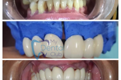 watermark_14-12-2018_04-32-24PM-1