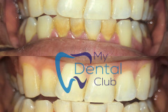 eZy-Watermark_17-11-2019_02-30-04PM