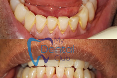 eZy-Watermark_17-11-2019_02-32-39PM