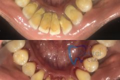 watermark_14-12-2018_04-20-09PM