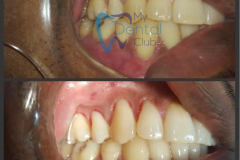 watermark_14-12-2018_04-32-59PM-1