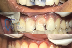 eZy-Watermark_05-03-2019_06-28-19PM