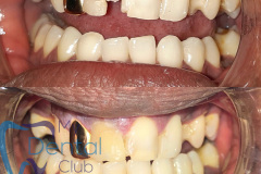 eZy-Watermark_17-11-2019_02-29-38PM