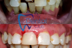 eZy-Watermark_17-11-2019_02-40-30PM