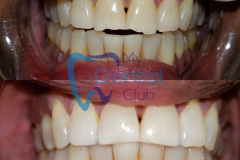 eZy-Watermark_17-11-2019_02-42-29PM