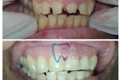 watermark_14-12-2018_04-24-56PM