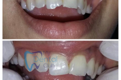 watermark_14-12-2018_04-28-44PM