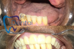 eZy-Watermark_17-11-2019_02-38-33PM