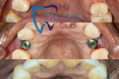 eZy-Watermark_17-11-2019_02-43-05PM