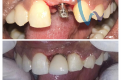 watermark_13-11-2018_05-25-35PM