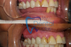 eZy-Watermark_17-11-2019_02-41-58PM