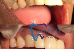 eZy-Watermark_17-11-2019_02-39-18PM