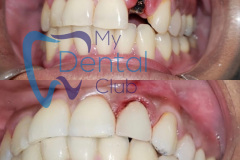 eZy-Watermark_03-05-2020_03-59-06PM-1