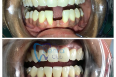 watermark_14-12-2018_04-23-37PM