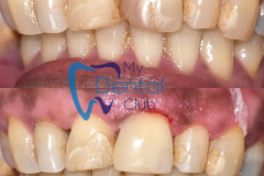 eZy-Watermark_07-01-2021_08-14-02PM