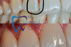 eZy-Watermark_17-11-2019_02-31-56PM