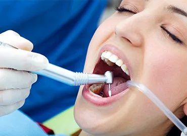 invisalign , implants , bridges , crowns trinidad dentist