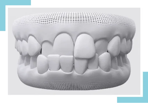invisalign