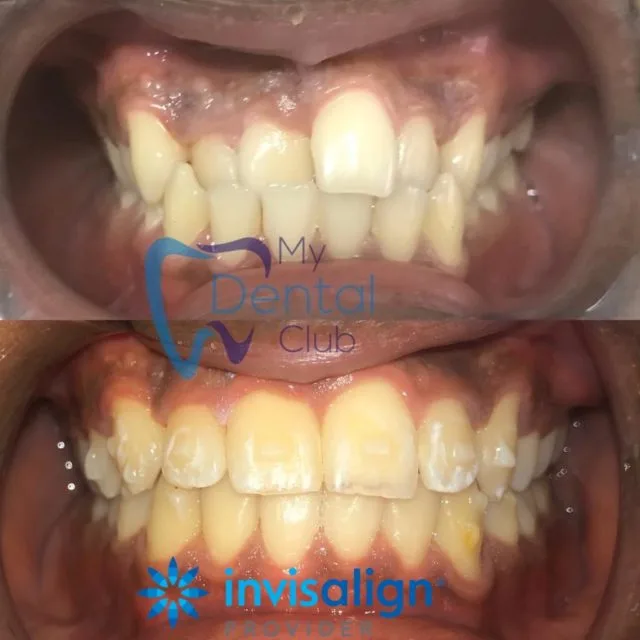invisalign dentist , cosmetic dentist , trinidad dentist