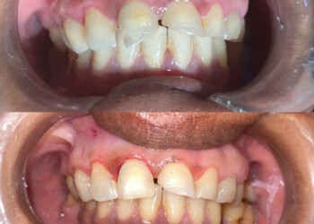 F1CD58C6-8BB0-4882-A4AB-44B47BB4F1BC