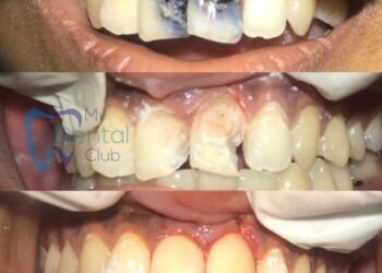 eZy-Watermark_05-03-2019_06-28-19PM