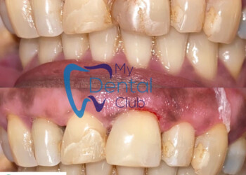 eZy-Watermark_07-01-2021_08-14-02PM