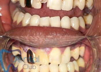 eZy-Watermark_17-11-2019_02-29-38PM