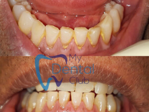 eZy-Watermark_17-11-2019_02-32-39PM