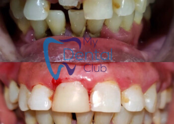 eZy-Watermark_17-11-2019_02-40-30PM