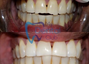 eZy-Watermark_17-11-2019_02-42-29PM