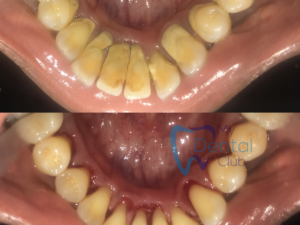 watermark_14-12-2018_04-20-09PM