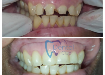 watermark_14-12-2018_04-24-56PM