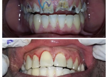 watermark_14-12-2018_04-25-30PM