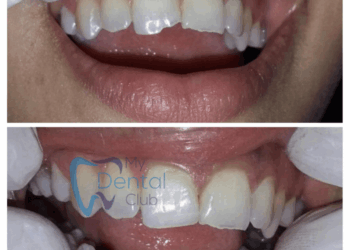 watermark_14-12-2018_04-28-44PM